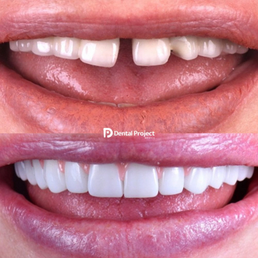 Slider image (5) Dental Project Mexico